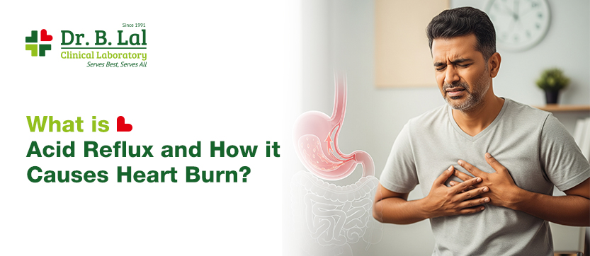 Acid Reflux Explained: Causes and Heartburn Link