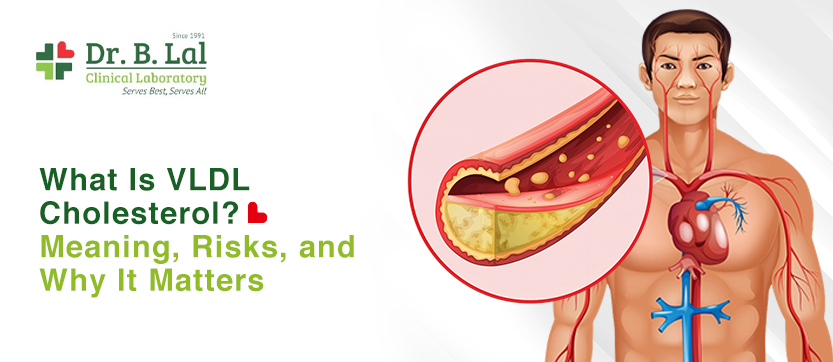 What Is VLDL Cholesterol? Meaning, Risks, And Why It Matters