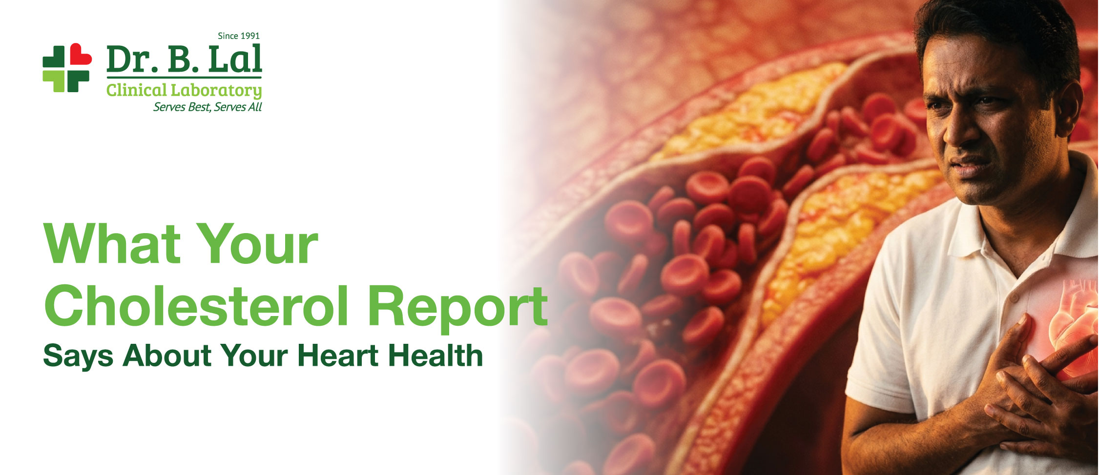 What Your Cholesterol Report Says About Your Heart Health