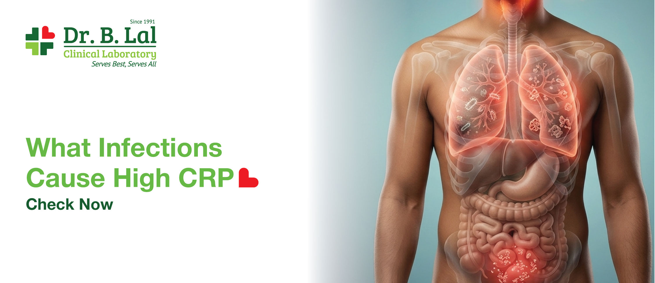 Which Infections Cause High CRP? Check Now