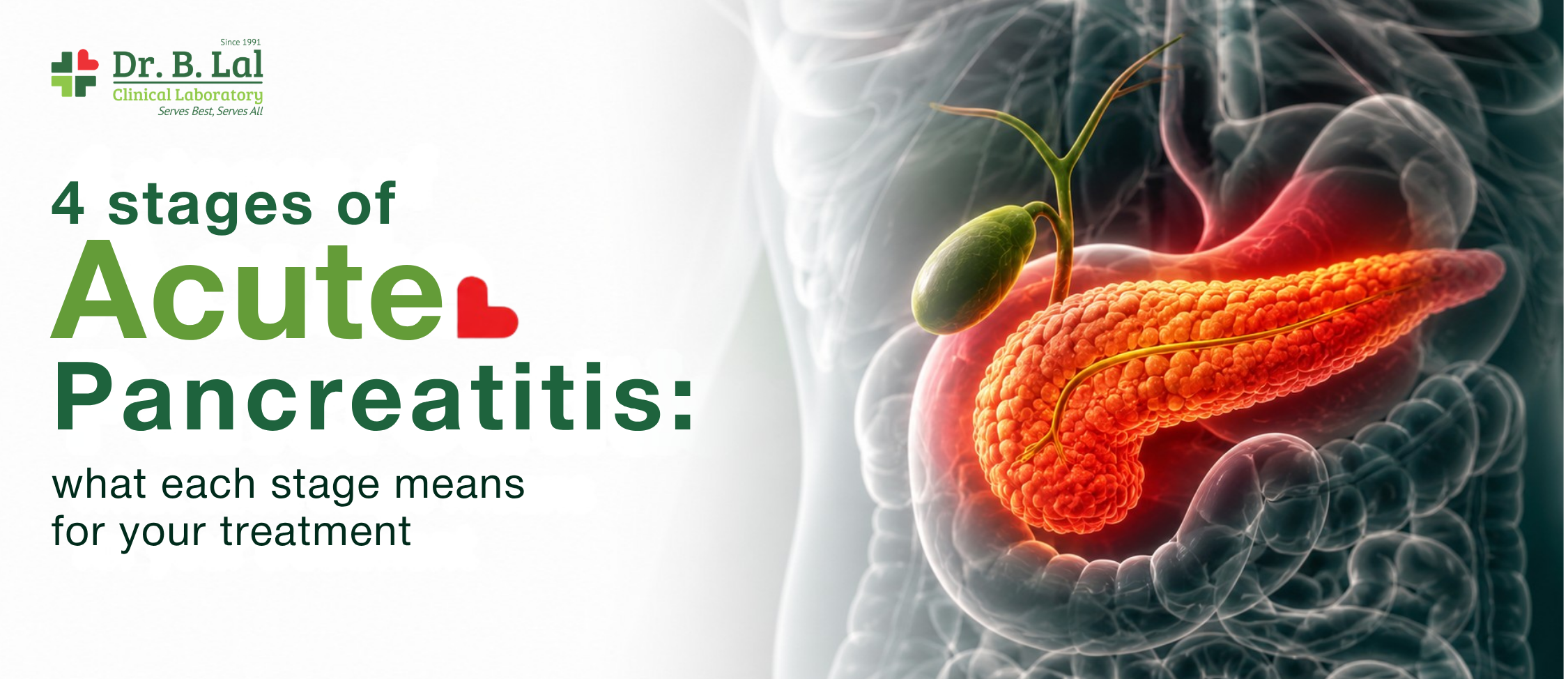 4 Stages of Acute Pancreatitis: What Each Stage Means for Your Treatment