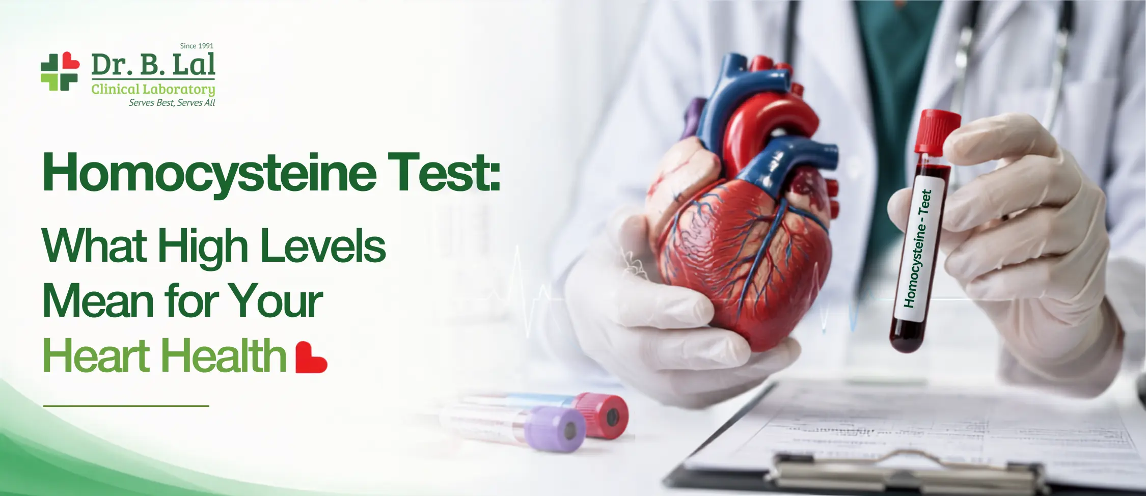 Homocysteine Test: What High Levels Mean for Your Heart Health
