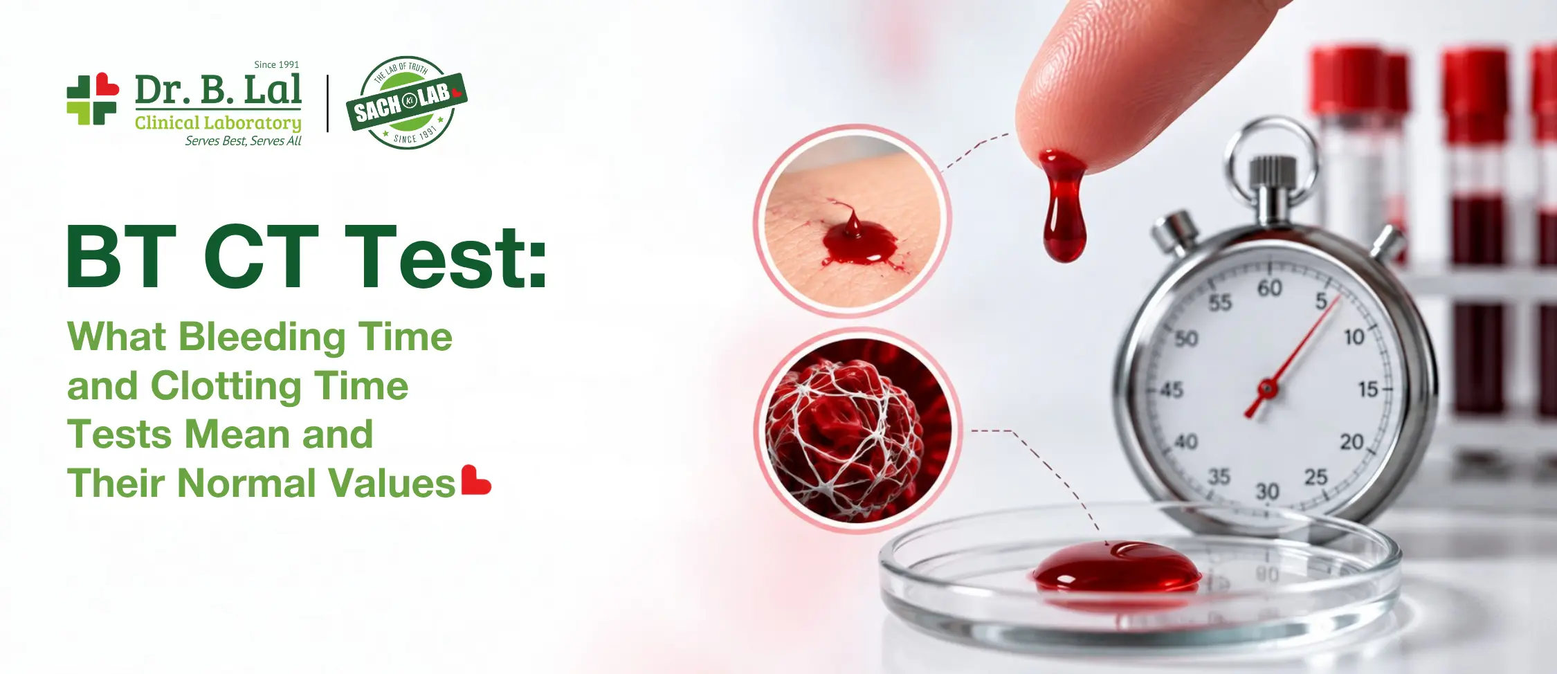 BT CT test: what Bleeding Time and Clotting Time tests mean and their normal values