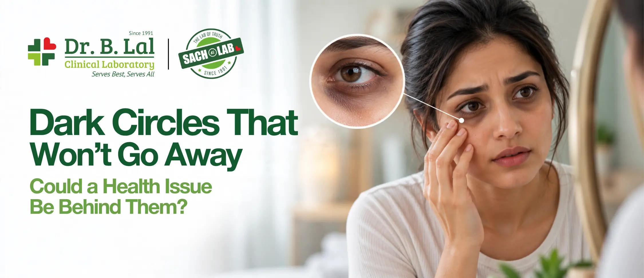 Dark Circles That Won't Go Away: Could a Health Issue Be Behind Them?