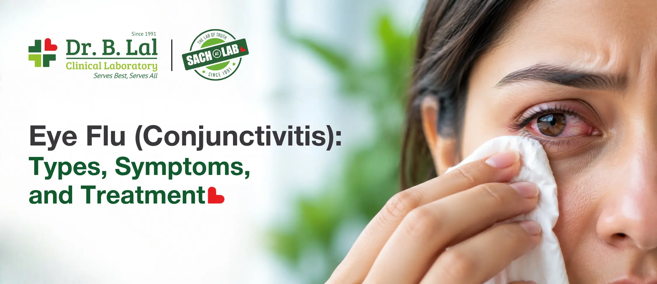 Eye Flu (Conjunctivitis): Types, Symptoms, and Treatment