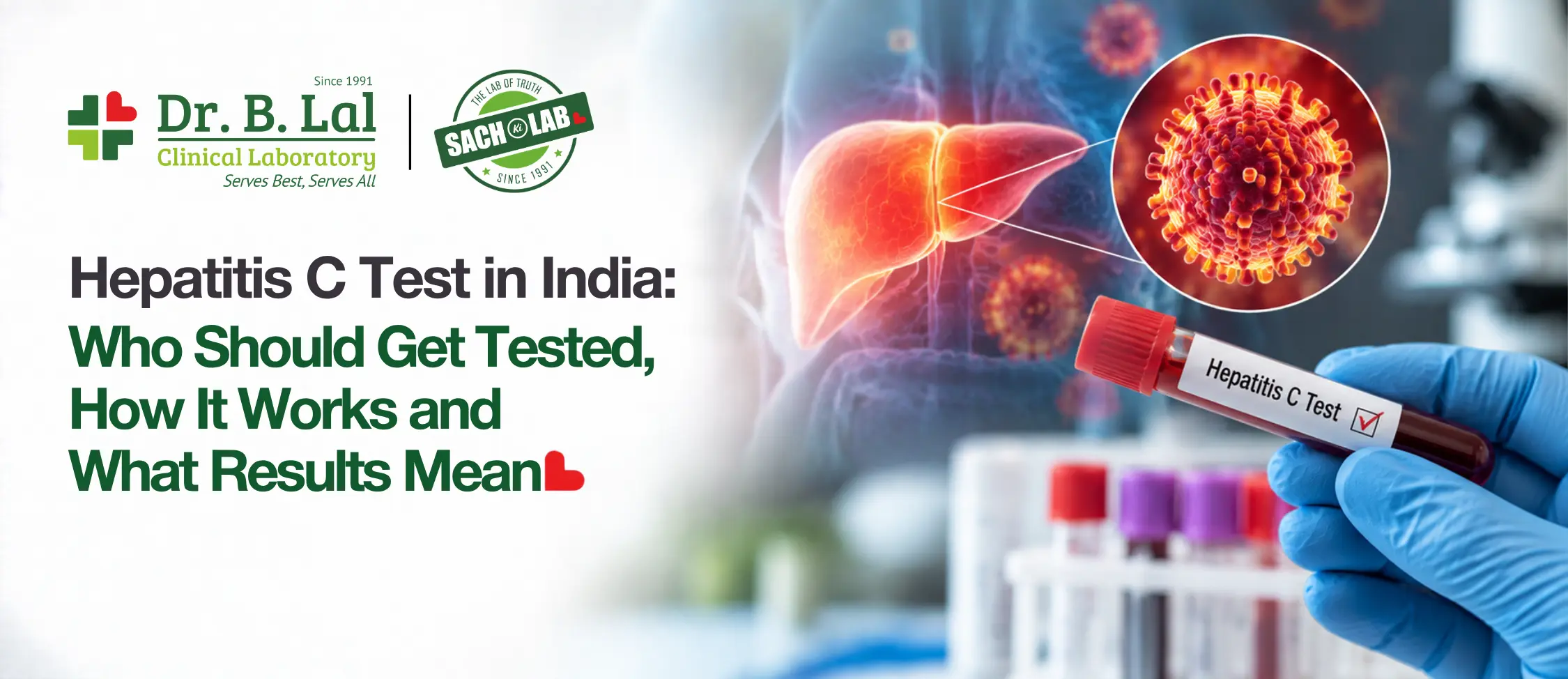 Hepatitis C Test in India: Who Should Get Tested, How It Works and What Results Mean